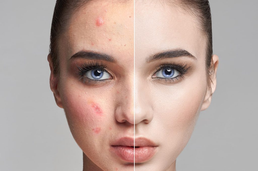 facial min 2 | Services | ROZA CARE, SKINCARE & BEAUTY - LOOK FLAWLESS, NATURALLY