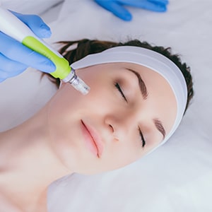 MICRO NEEDLING